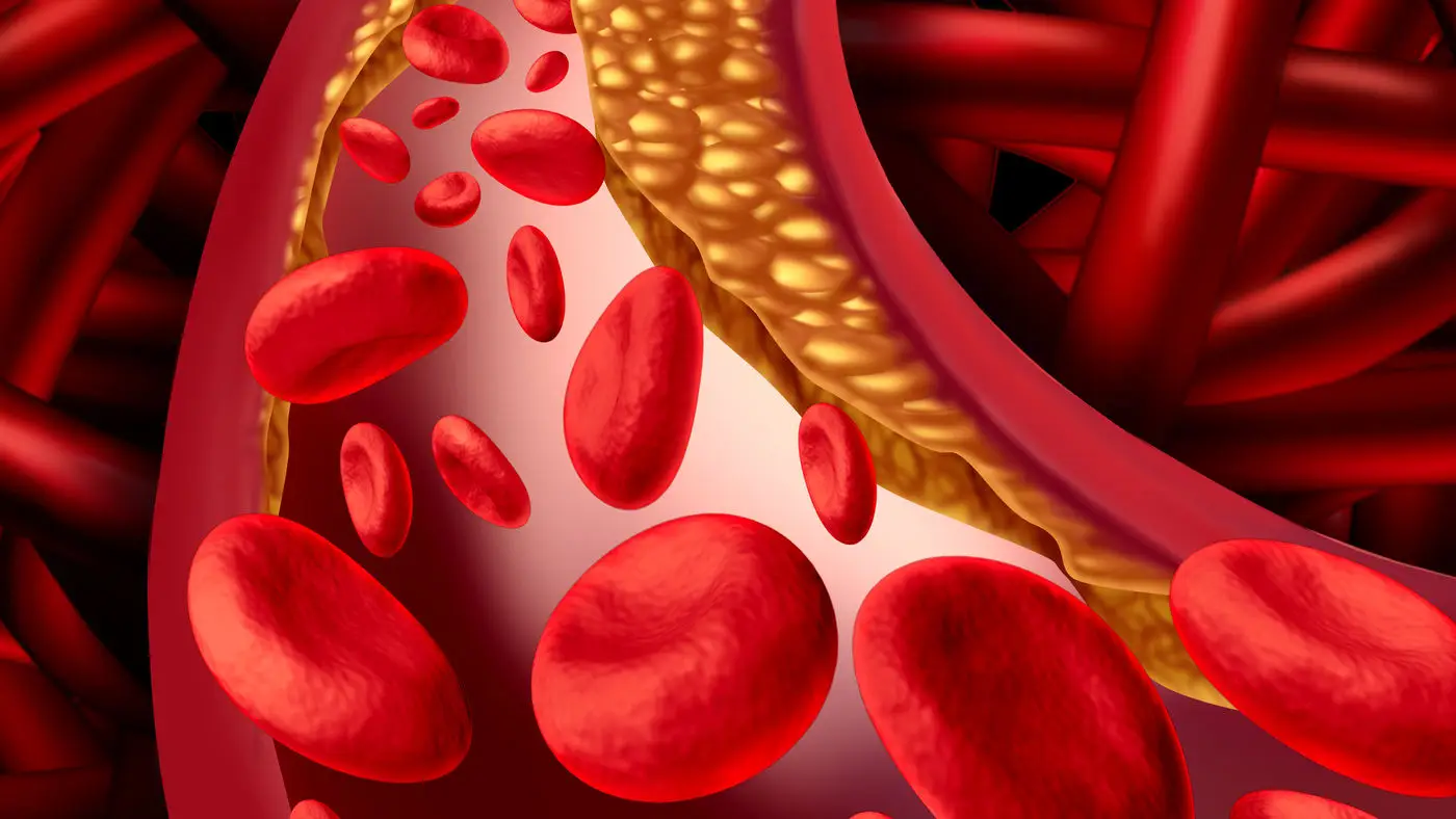 Hai il colesterolo totale alto? Ecco cosa significa davvero per la tua salute e quando preoccuparsi