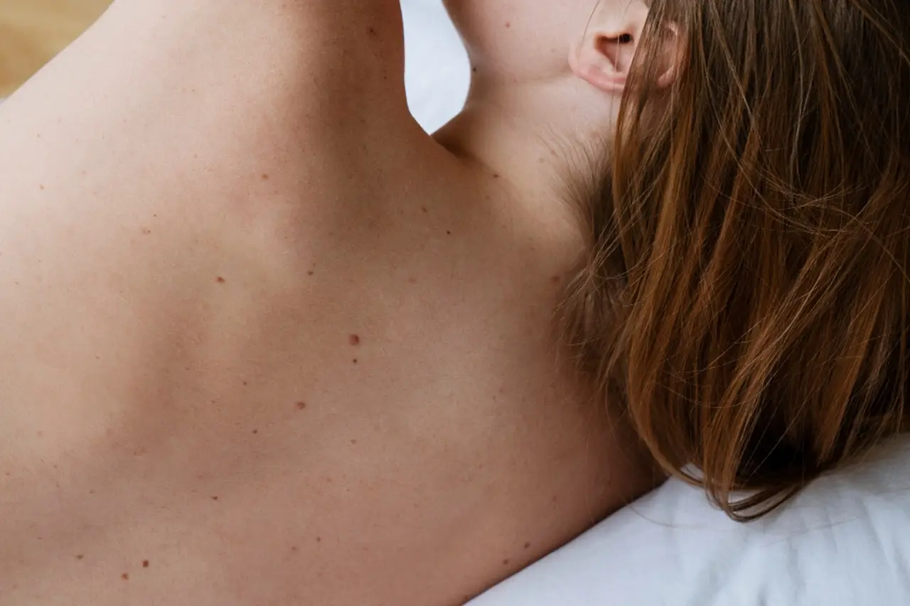 Vai troppo poco dal dermatologo: ecco ogni quanto dovresti fare un controllo per salvarti la vita
